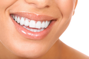invisalign paris 20 invisalign paris 20 eme